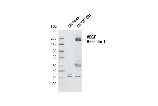 VEGF Receptor 1 Antibody