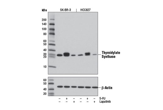 Thymidylate Synthase (D5B3) XPRabbit mAb