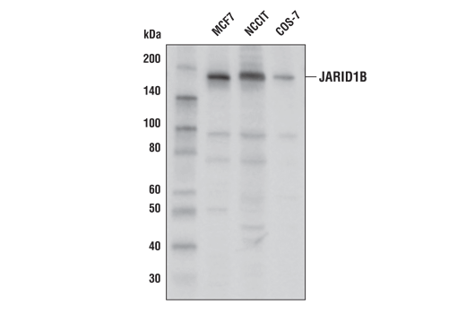 JARID1B (E2X6N) Rabbit mAb
