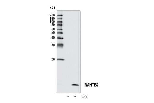RANTES (R40) Antibody