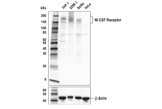 M-CSF Receptor (E4T8Z) Rabbit mAb