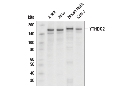YTHDC2 Antibody