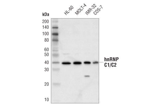 hnRNP C1/C2 (D6S3N) Rabbit mAb