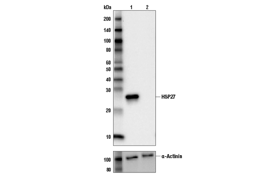 HSP27 (G31) Mouse mAb