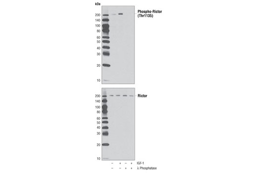 Phospho-Rictor (Thr1135) (D30A3) Rabbit mAb