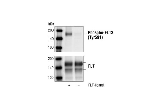 Phospho-FLT3 (Tyr591) (54H1) Mouse mAb