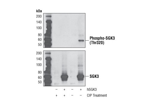 Phospho-SGK3 (Thr320) (D30E6) Rabbit mAb