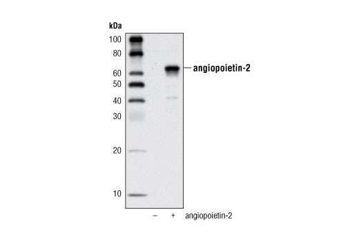 Angiopoietin-2 Antibody