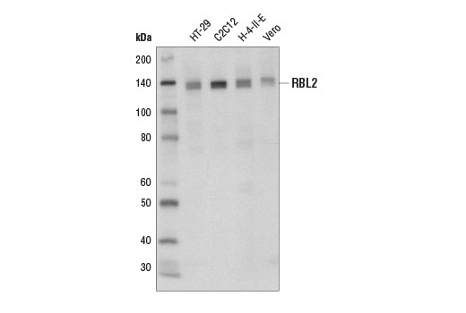 RBL2 (D9T7M) Rabbit mAb