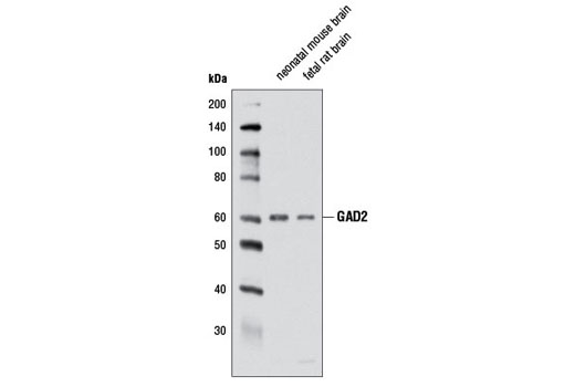 GAD2 (D5G2) XP Rabbit mAb