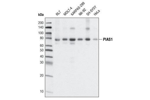 PIAS1 (D33A7) XP Rabbit mAb