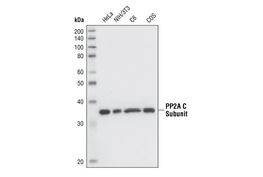 PP2A C Subunit (52F8) Rabbit mAb