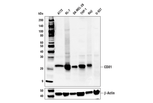 CD81 (D3N2D) Rabbit mAb