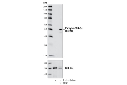Phospho-GSK-3α (Ser21) (36E9) Rabbit mAb