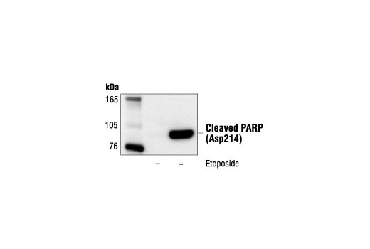 Cleaved PARP (Asp214) (19F4) Mouse mAb (Human Specific)