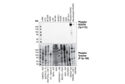 Phospho-VEGF Receptor 2 (Tyr1175) (19A10) Rabbit mAb