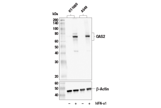 OAS2 (E2G4K) Rabbit mAb
