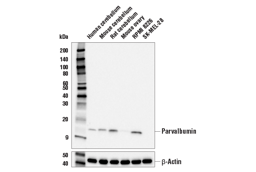 Parvalbumin (E8N2U) XP Rabbit mAb