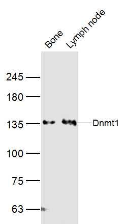 DNA甲基转移酶1抗体