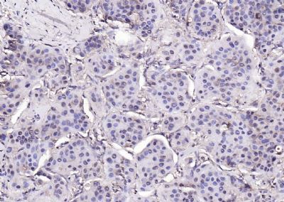 磷酸化富含脯氨酸的酪氨酸激酶2抗体