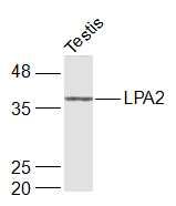 溶血磷脂酸受体蛋白2抗体