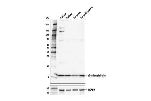 β2-microglobulin Antibody