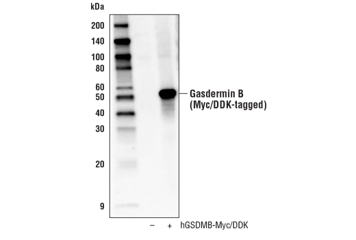 Gasdermin B Antibody