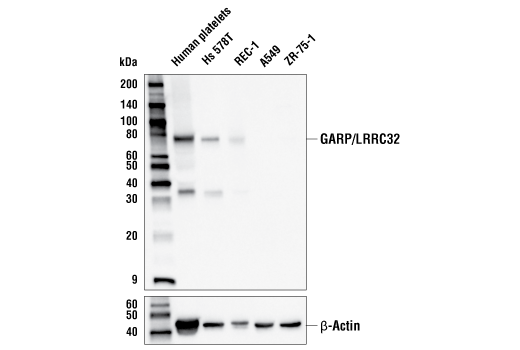 GARP/LRRC32 (E2L6B) Rabbit mAb