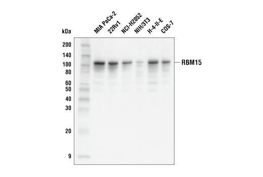 RBM15 (E8Y8A) Rabbit mAb