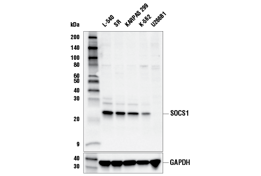 SOCS1 (E4K7Q) Rabbit mAb