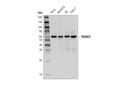 HDAC2 (D6S5P) Rabbit mAb