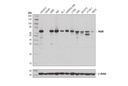 NF-κB Family Antibody Sampler Kit II