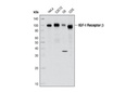 IGF-I Receptor β Antibody