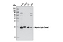 Myosin Light Chain 2 (D18E2) Rabbit mAb