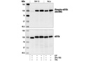 Phospho-eEF2k (Ser366) Antibody