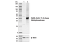 SARS-CoV-2 2'-O-ribose Methyltransferase Antibody